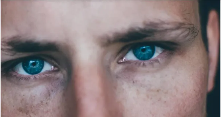 Man with dark Circle Eyes